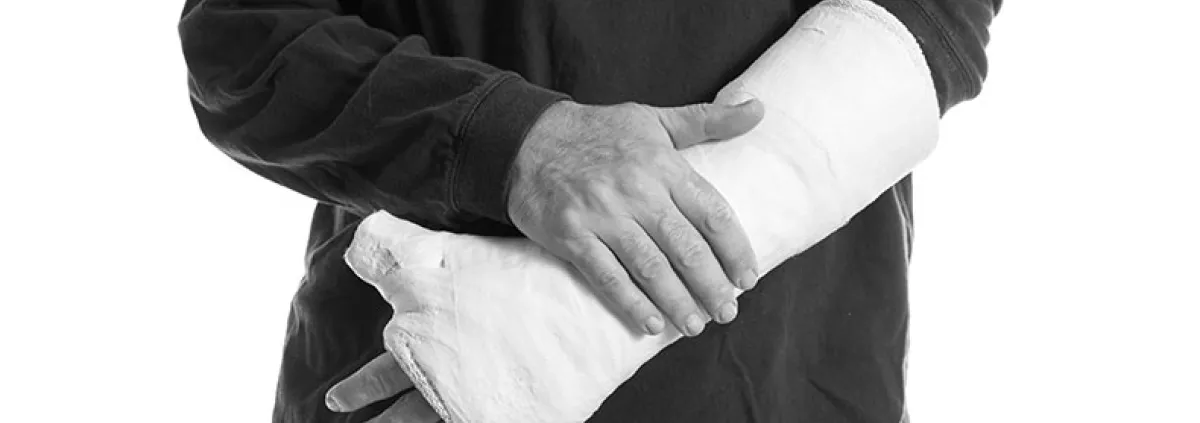 man with broken arm in a cast